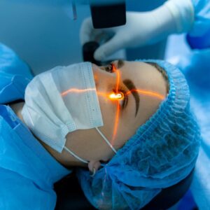 Laser Cataract Surgery